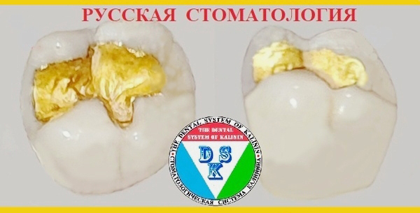 G15.jpg