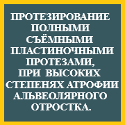 J36.png