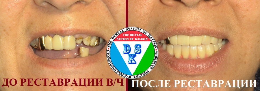 X53